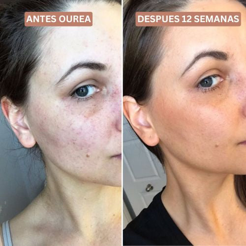 Ourea - Bronceado saludable