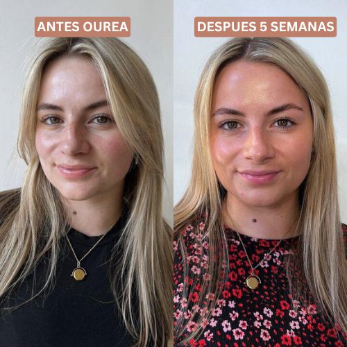 Ourea - Bronceado saludable